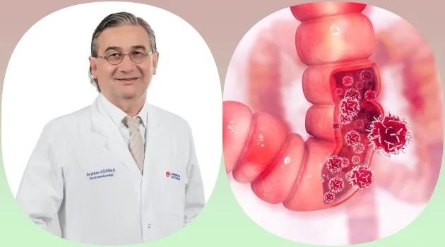 Kolon Kanserinde Erken Teşhis ve Tedavi Hayat Kurtarıyor