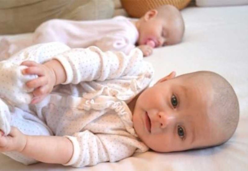 150 BİN BEBEK  PREMATÜRE DOĞUYOR