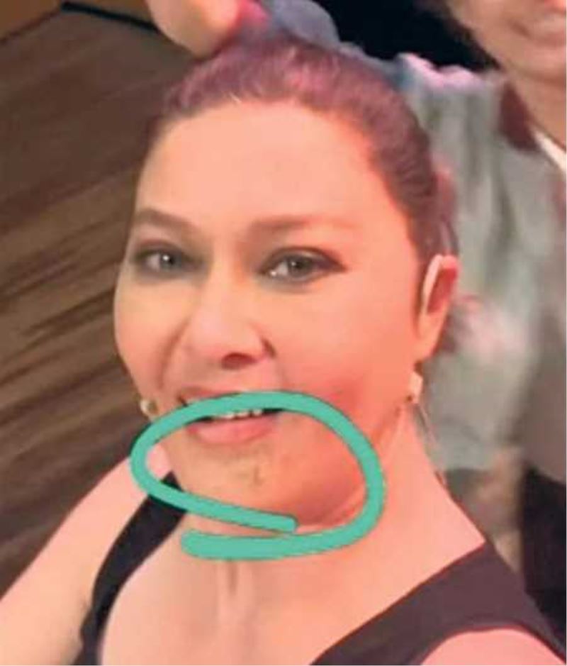AZICIK YAMUĞUM