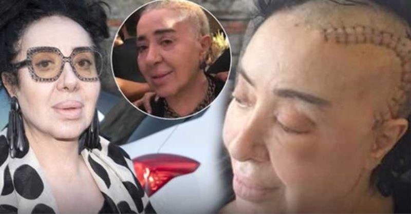 Nur Yerlitaş son halini paylaştı! Sevenlerinden destek yağdı!