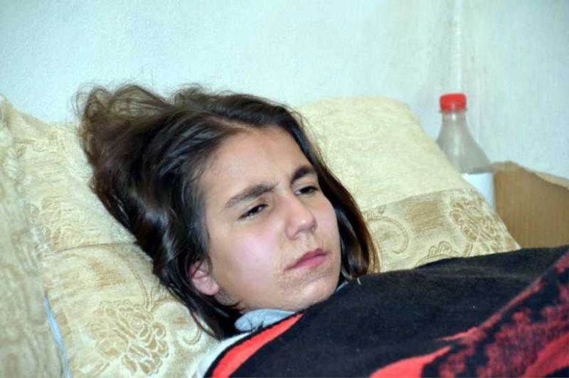 Sürekli kaşınan Yeliz, iyileşmek istiyor